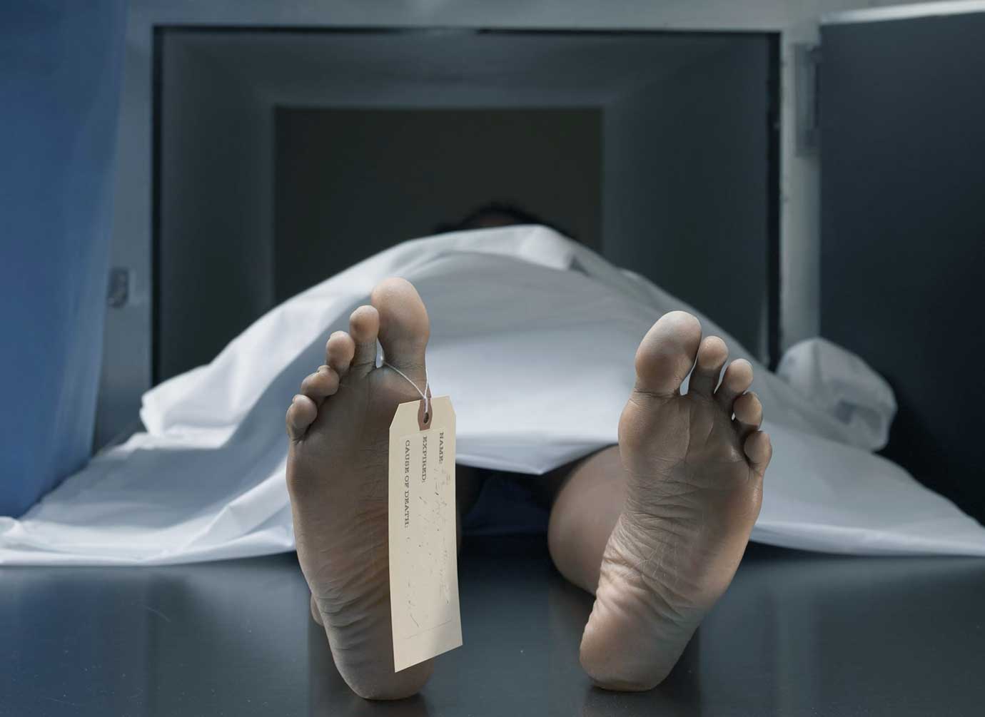 Cadaver en una morgue