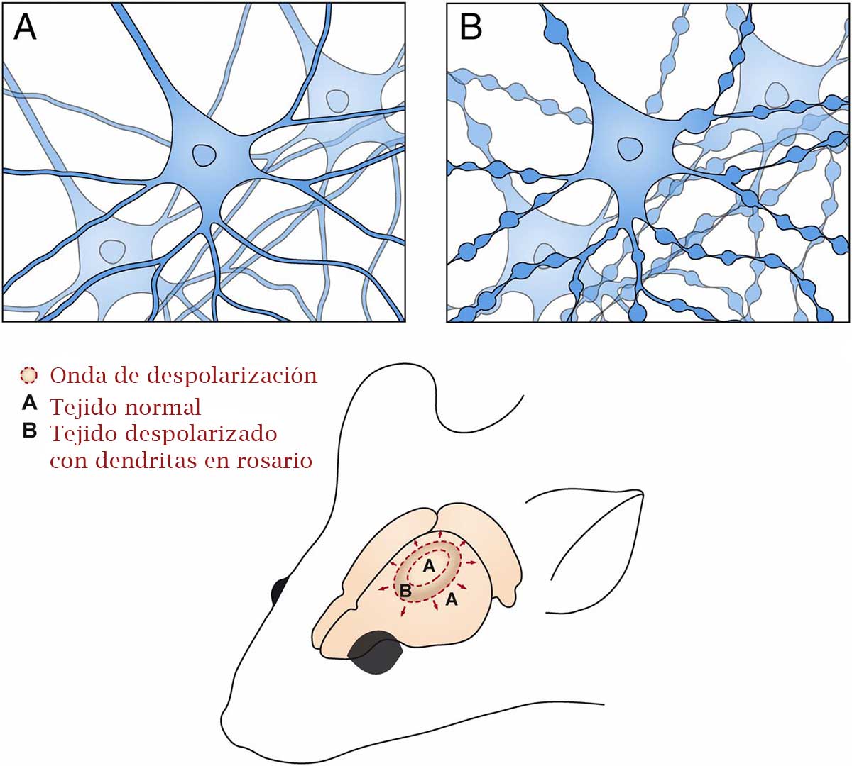 neuronas despolarizadas
